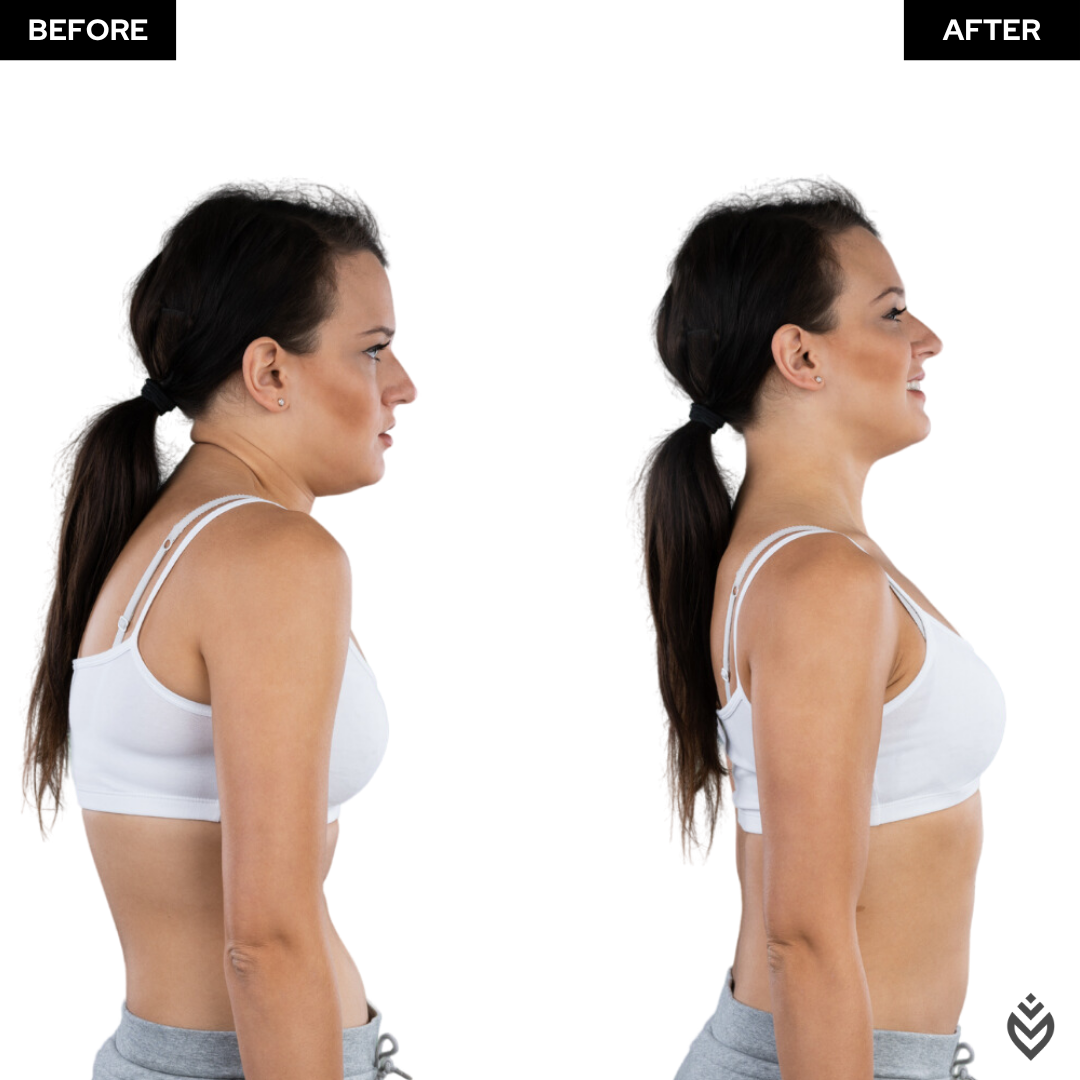 SereneSpine™ Posture Corrector