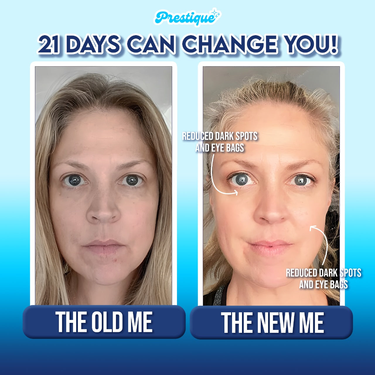 SnatchLift™ Neck Sculptor