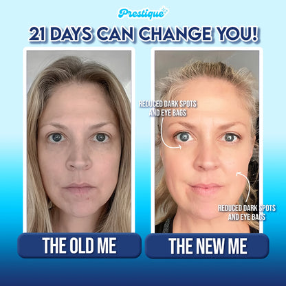 SnatchLift™ Neck Sculptor